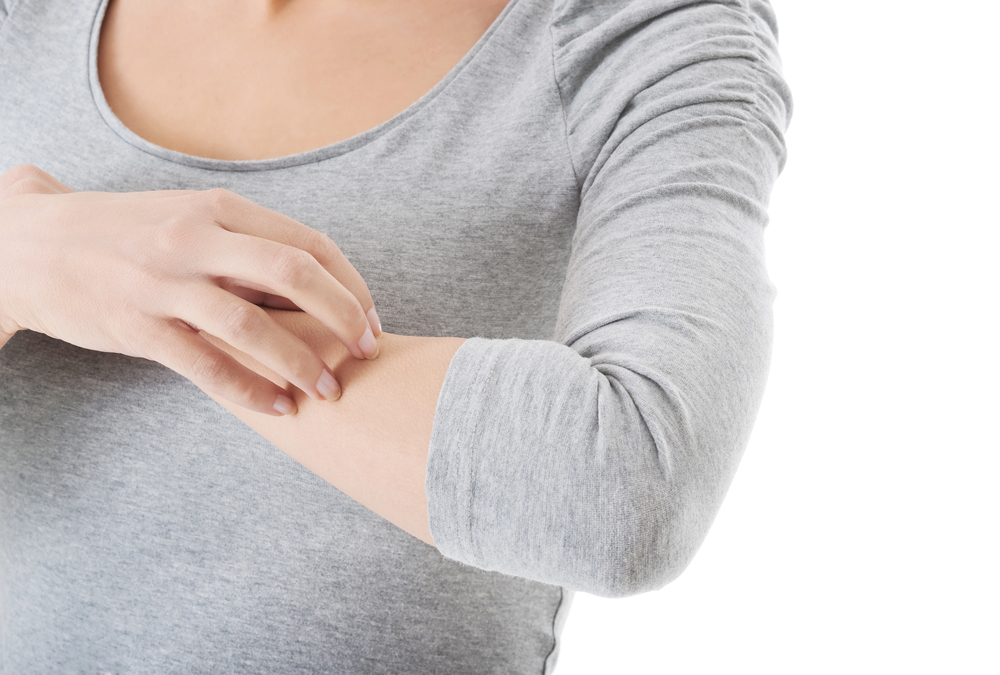 Remédio caseiro para Eczema 5 Remédio caseiro para Eczema