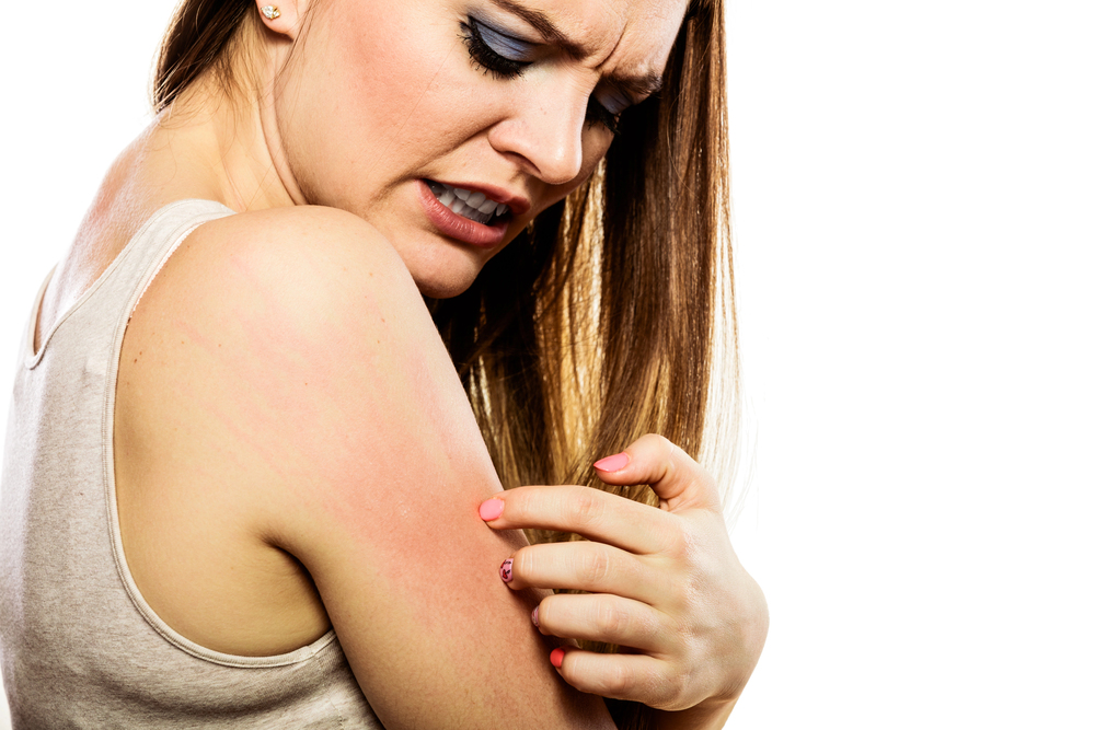 Remédio caseiro para Eczema 3 Eczema